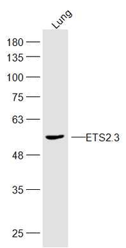 ETS2.3 Rabbit Polyclonal Antibody
