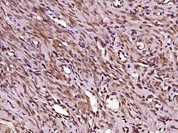 Phospho-Estrogen Receptor alpha (Ser106) Rabbit Polyclonal Antibody