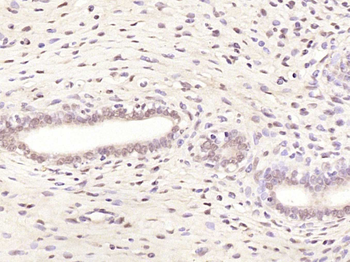 Phospho-Estrogen Receptor alpha (Ser106) Rabbit Polyclonal Antibody