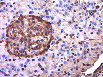 EXOC3L2 Rabbit Polyclonal Antibody