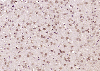 FAM175B Rabbit Polyclonal Antibody