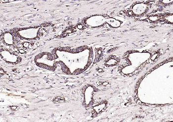 FAM83H Rabbit Polyclonal Antibody