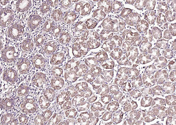 FAM83H Rabbit Polyclonal Antibody