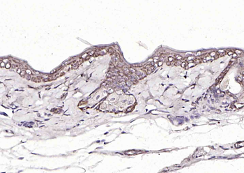FAM83H Rabbit Polyclonal Antibody