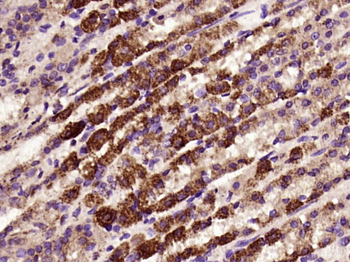 FAM83H Rabbit Polyclonal Antibody