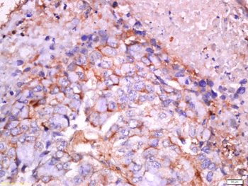 Phospho-EphB1+EphB2 (Tyr594) Rabbit Polyclonal Antibody