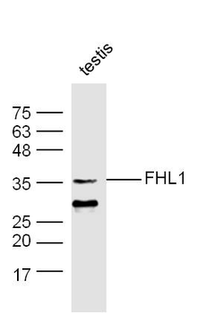 FHL1 Rabbit Polyclonal Antibody