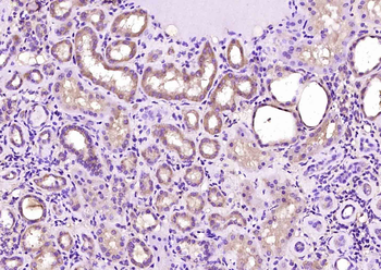 Folate Receptor alpha Rabbit Polyclonal Antibody