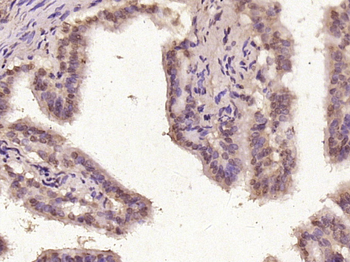 FAM122B Rabbit Polyclonal Antibody