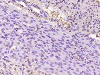 FAM122B Rabbit Polyclonal Antibody