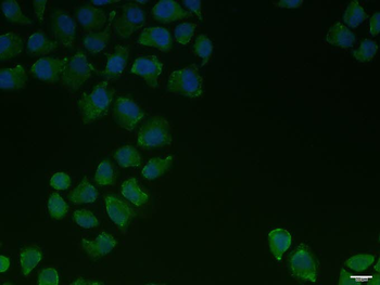 PIEZO1 Rabbit Polyclonal Antibody