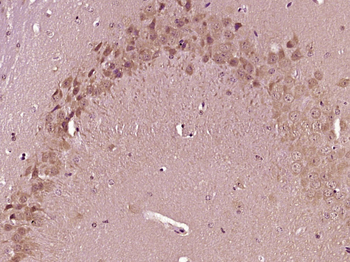PIEZO1 Rabbit Polyclonal Antibody