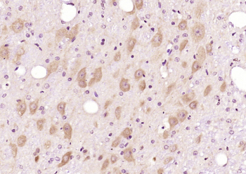 FCP1 Rabbit Polyclonal Antibody