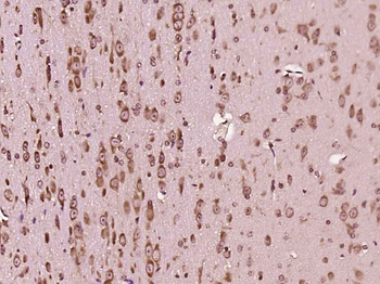 FGD1 Rabbit Polyclonal Antibody