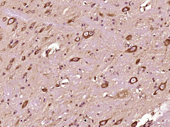 FGD1 Rabbit Polyclonal Antibody