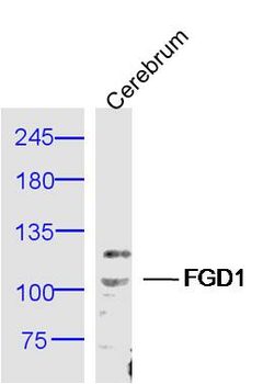 FGD1 Rabbit Polyclonal Antibody