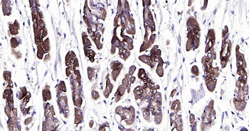 FGD3 Rabbit Polyclonal Antibody