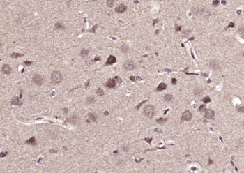 RNF59/MID1 Rabbit Polyclonal Antibody