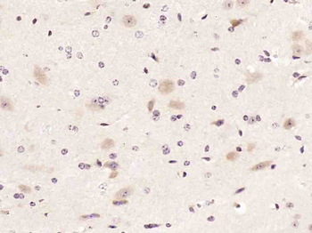 FAR2 Rabbit Polyclonal Antibody