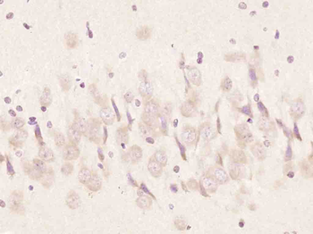 FAR2 Rabbit Polyclonal Antibody
