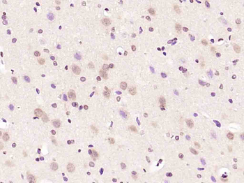 FAR2 Rabbit Polyclonal Antibody