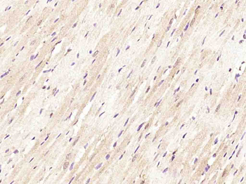 FAR2 Rabbit Polyclonal Antibody