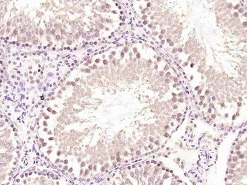 FAR2 Rabbit Polyclonal Antibody