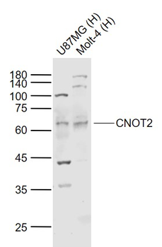 CNOT2 Rabbit Polyclonal Antibody