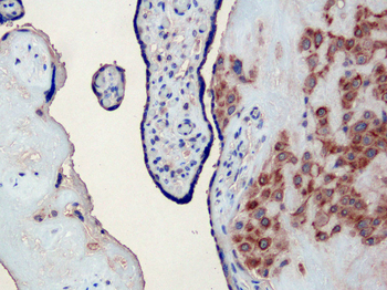 GRO Alpha Rabbit Polyclonal Antibody