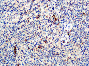 GRO Alpha Rabbit Polyclonal Antibody