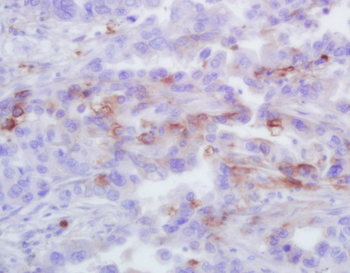 GRO Alpha Rabbit Polyclonal Antibody