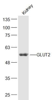 GLUT2 Rabbit Polyclonal Antibody