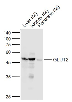 GLUT2 Rabbit Polyclonal Antibody