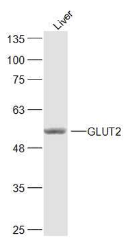 GLUT2 Rabbit Polyclonal Antibody
