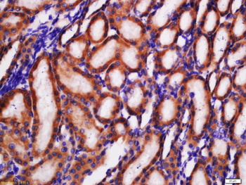 GLUT2 Rabbit Polyclonal Antibody