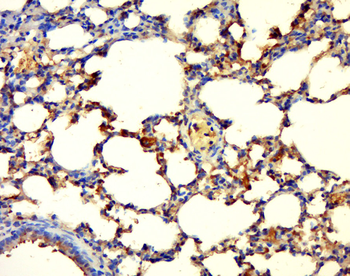 GPD1L Rabbit Polyclonal Antibody