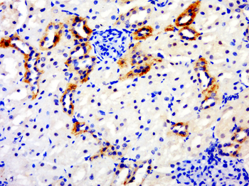 GPD1L Rabbit Polyclonal Antibody