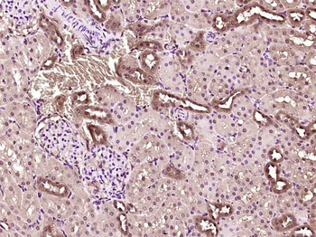 GRWD1 Rabbit Polyclonal Antibody