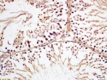 GSTM3 Rabbit Polyclonal Antibody