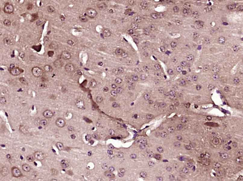 GSTT4 Rabbit Polyclonal Antibody