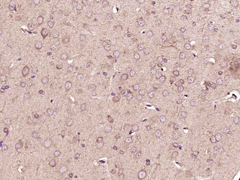 GSTT4 Rabbit Polyclonal Antibody