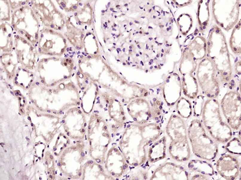 GTF3C5 Rabbit Polyclonal Antibody