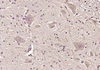 GGCX Rabbit Polyclonal Antibody