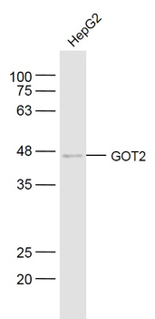 GOT2 Rabbit Polyclonal Antibody
