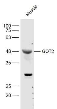 GOT2 Rabbit Polyclonal Antibody