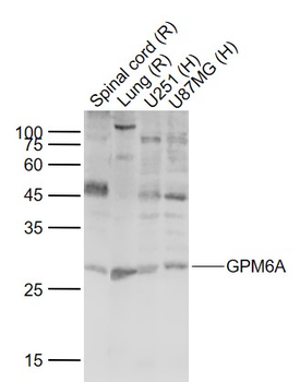GPM6A Rabbit Polyclonal Antibody