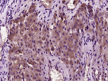 Hepcidin-25 Rabbit Polyclonal Antibody