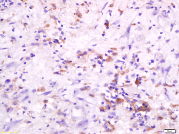 HLA Class 1 ABC /HLA ABC Rabbit Polyclonal Antibody