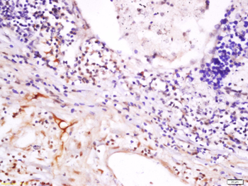 HLA Class 1 ABC /HLA ABC Rabbit Polyclonal Antibody