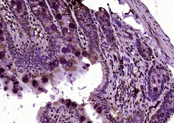 Histone H3 (Acetyl Lys9/14) Rabbit Polyclonal Antibody